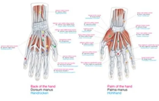 Anatomie poster Triggerpoints Groot 70 x 100 cm