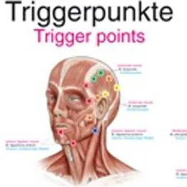 Anatomie poster Triggerpoints Groot 70 x 100 cm